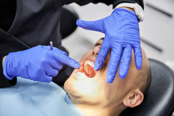 Best Emergency Tooth Extraction in Mountain View, NC