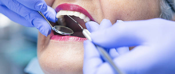 Best Emergency Tooth Extraction in Mountain View, NC